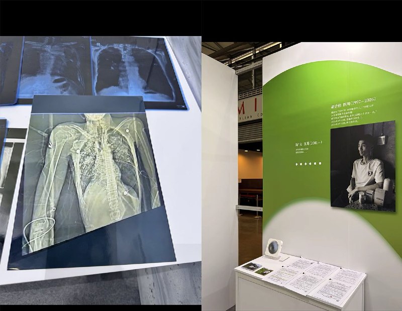 近日，“大爱清尘”在上海举办了一场聚焦90后尘肺病工人的公益展览，展示了多名因石材加工粉尘导致尘肺病而英年早逝的工人案例