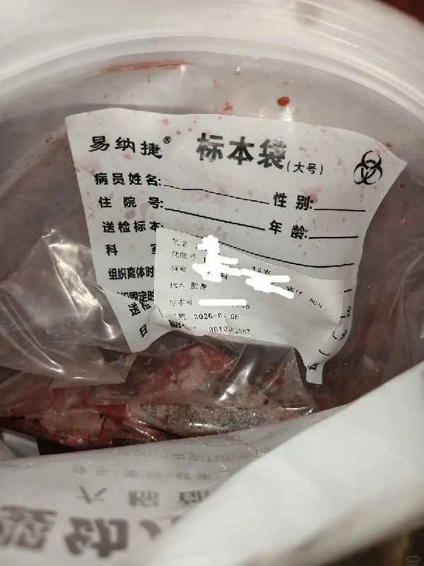 8月16日，山东一名网友发帖称，自己在家中冰箱里发现了亲戚生产后留下的胎盘，家人告诉她，这是准备“做给爸爸吃”的