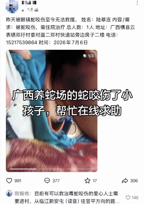 【广西洪水】7月7日，横州市云表镇，一小孩被出逃的眼镜蛇咬伤后，因抢救不及时而去世