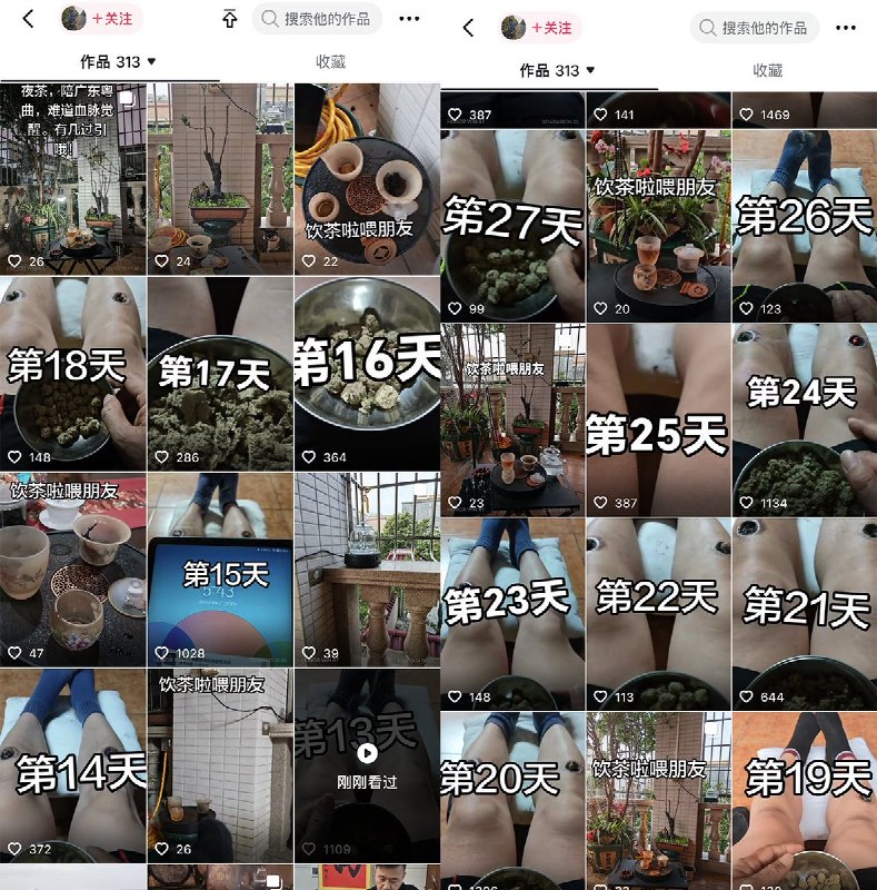 最近，广东中山一名男子自学中医，每天用艾灸灼烧自己的双腿，并用视频记录下每天艾灸的过程以及身体变化