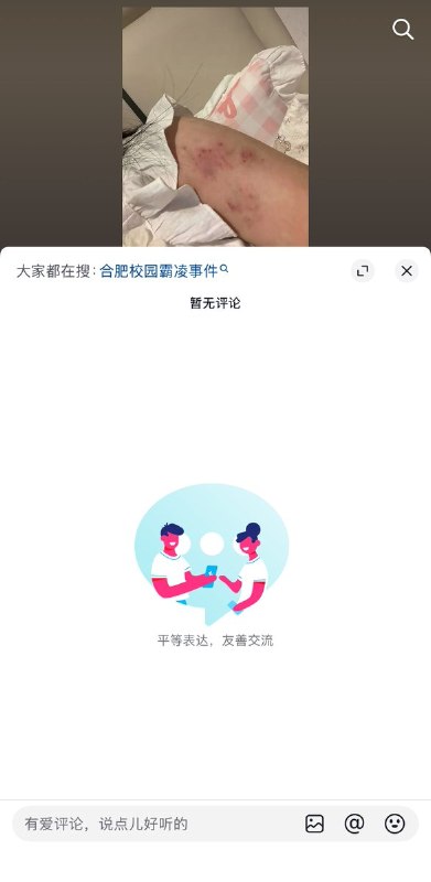 5月10日，一名来自安徽合肥的女孩，讲述自己上初中后遭到校园霸凌的经历，并晒出了被同学们打到淤青的身体，随后抖音出手，清空了所有评论，并删除了女孩发布的贴文