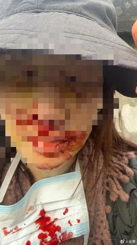 1月30日，金晨发布道歉信内容如下：大家好，我是 金晨，关于近日网上流传的消息，我想向大家做出如下说明：2025年3月16日，我和经纪人及助理三人租车在外游玩，车辆由我进行驾驶