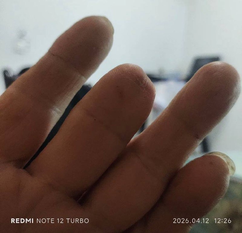 网友晒当年在章木头收容所被打致残和罚款证据