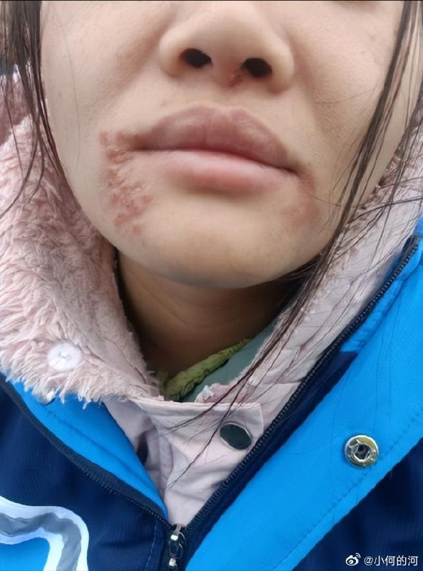 近日，湖北一名32岁女生讲述了自己被送入一家所谓“青少年成长训练机构”的经历